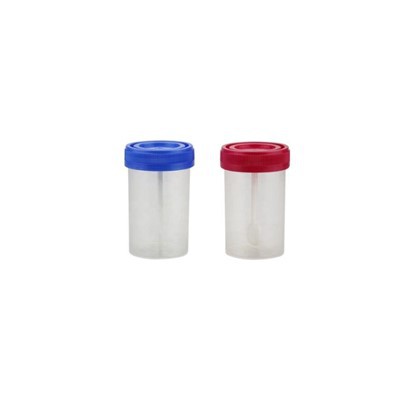 Disposable Sterile Urine Cup